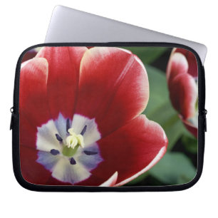 Funda Para Portátil Países Bajos (también conocido como Holanda), Liss