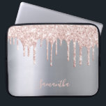 Funda Para Portátil Purpurina rosado plateado goteo nombre metálico ni<br><div class="desc">Una elegante caja de ipad de glamur y gambas. Faux rosa oro y goteo purpurina rosado,  goteo de pintura. Moda imitación de fondo metálico plateado. Inserte su nombre,  escrito con un guión de estilo moderno con letras a mano. oro Rosa,  letras de color rosa.</div>