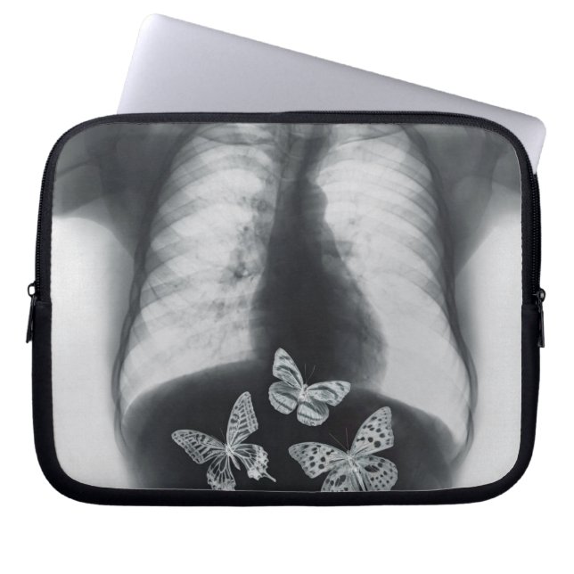 Funda Para Portátil Radiografía de mariposas en el estómago (Frente)
