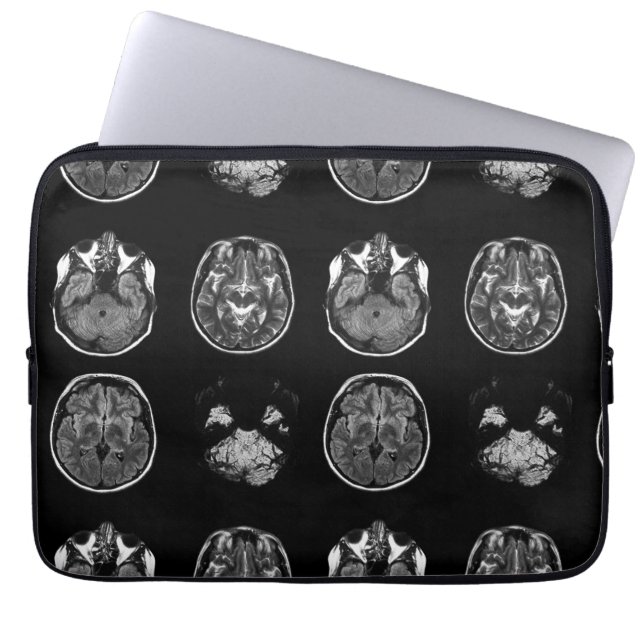 Funda Para Portátil Resonancia magnética cerebral (Frente)