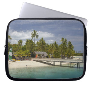 Funda Para Portátil Resort Plantation Island, isla Malolo Lailai