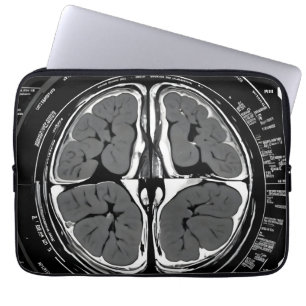 Funda Para Portátil Revisión cerebral por resonancia magnética