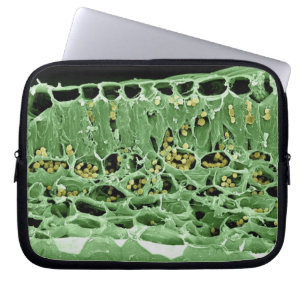 Funda Para Portátil Sección representativa de la hoja