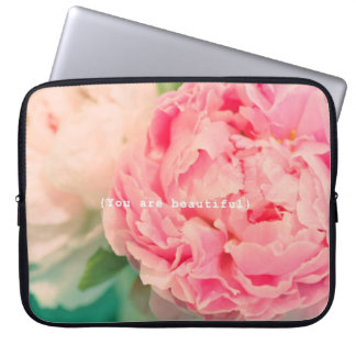 Funda Para Portátil Usted es hermoso