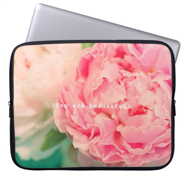 Funda Para Portátil Usted es hermoso (Frente)