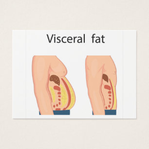 Grasa visceral