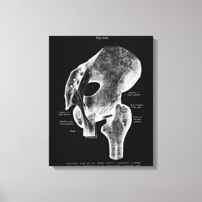 Hip Joint Anatomía Médica Gran Arte De Lienzo (Anverso)