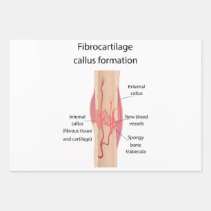 Hoja De Papel De Regalo Formación de Callus fibrocartílico