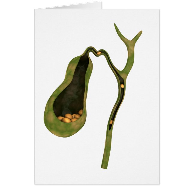 Imagen Conceptual De Gallstones Inside Gall (Frente)