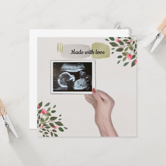 Imagen de exploración de Invitación para bebés (Anverso/Reverso In Situ)