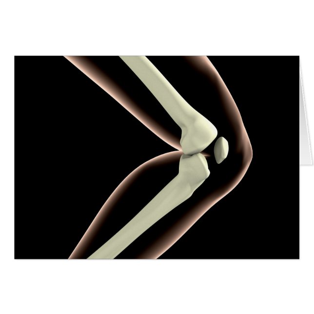 Imagen De Rayo X De Knee 1 (Anverso (Horizontal))
