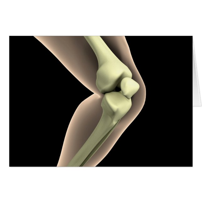Imagen De Rayo X De Knee 2 (Anverso (Horizontal))
