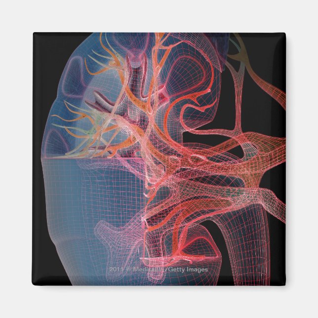 Imán Alambre del interior de un riñón (Frente)