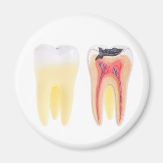 Imán Anatomía de dientes