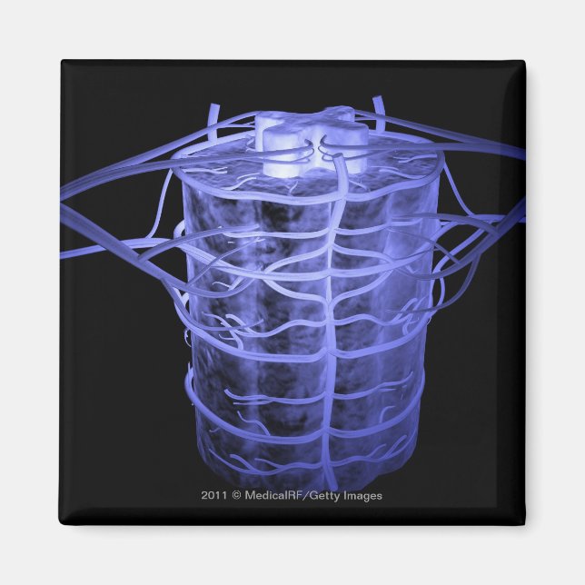 Imán Arterias que rodean parte de la columna vertebral (Frente)