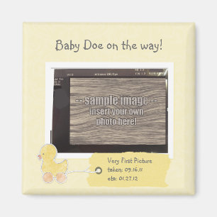 Imán Bebé amarillo Ultrasonido Personalizado de fotogra