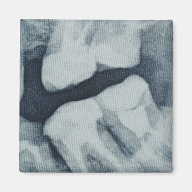 Imán Cierre de una radiografía dental (Frente)