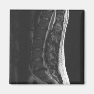 Imán de disco retorcido