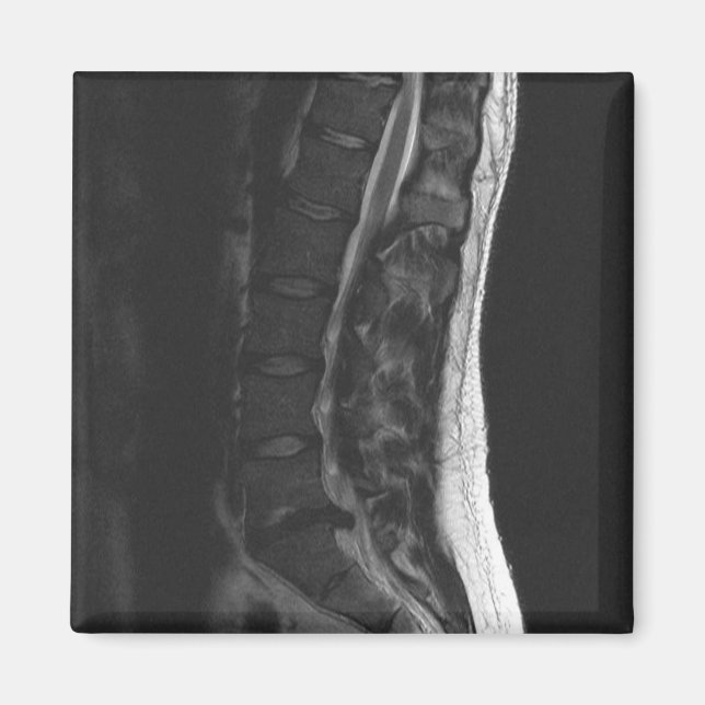 Imán de disco retorcido (Frente)