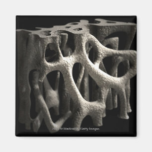 Imán Estructura de un hueso con osteoporosis