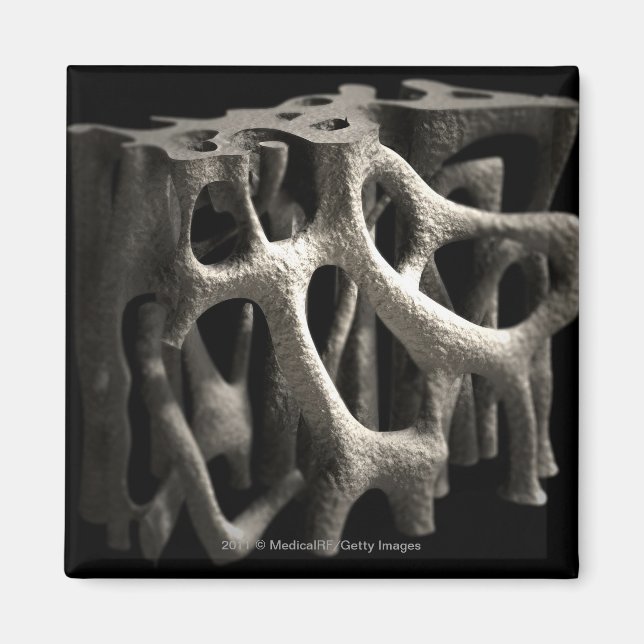 Imán Estructura de un hueso con osteoporosis (Frente)