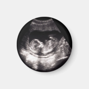 Imán Foto de anuncio de embarazo de ultrasonido de bebé