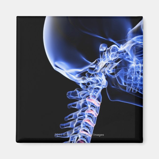 Imán Imagen de rayos X de los huesos del cuello (Frente)