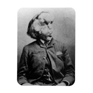 Imán José "Juan" Merrick Elephant Man a partir de 1889