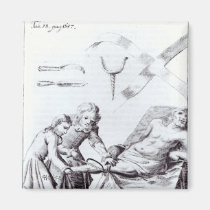 Imán Operación quirúrgica para amputar una pierna