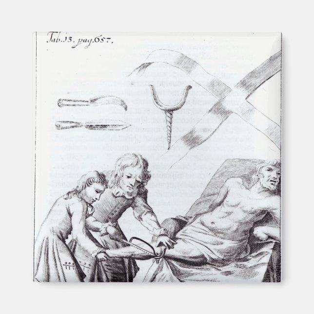 Imán Operación quirúrgica para amputar una pierna (Frente)