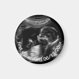 Imán Para la nueva madre, primer hijo con ultrasonido