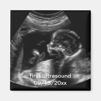 Imán Para la nueva madre, primer hijo con ultrasonido