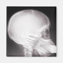 Imán Pie en rayos X de boca