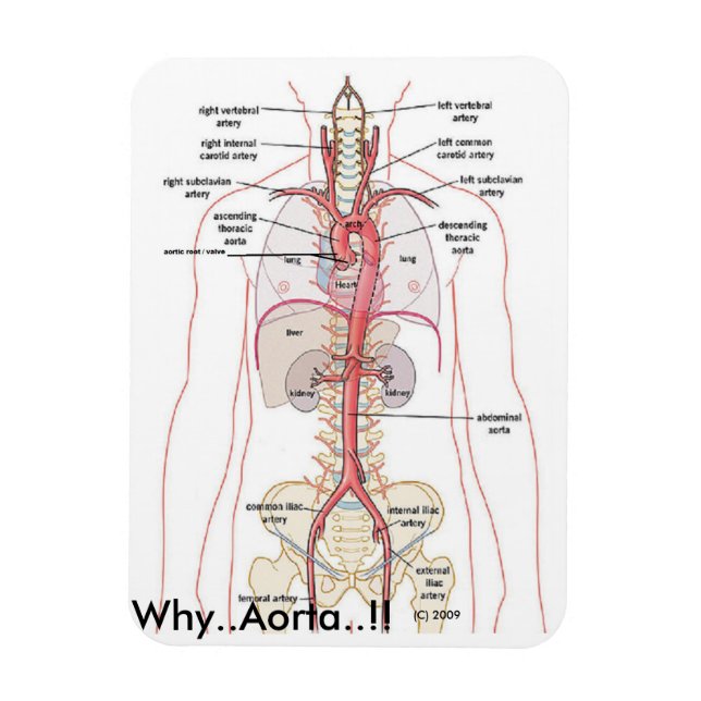 Imán ¡¡¡POR QUÉ... Aorta!!! Anatomía aórtica (Vertical)