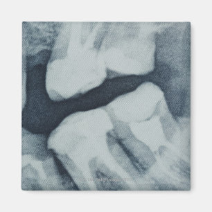 Imán Primer de una radiografía dental