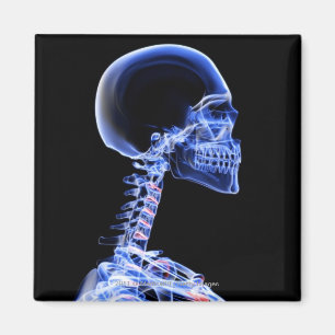 Imán Radiografía de los huesos en el cuello