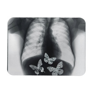 Imán Radiografía de mariposas en el estómago