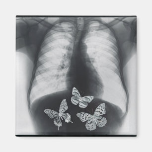 Imán Radiografía de mariposas en el estómago