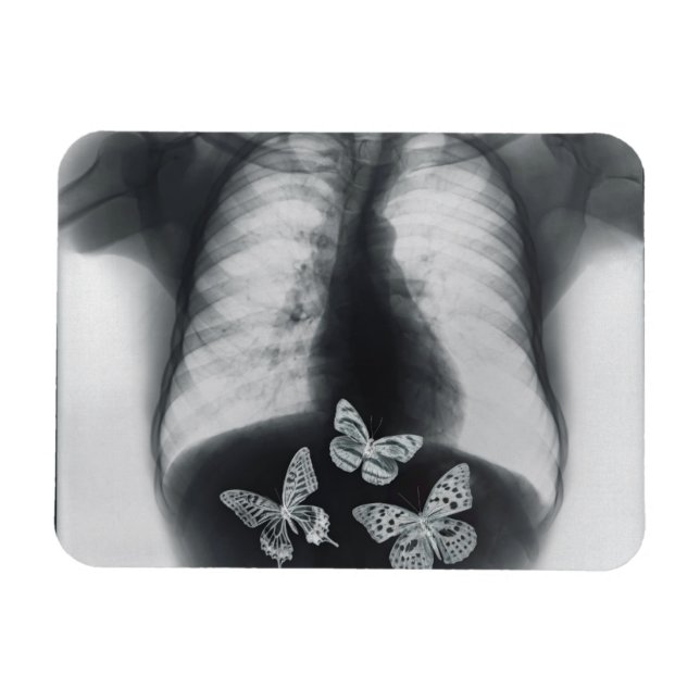 Imán Rayos X de mariposas en el estómago (Horizontal)