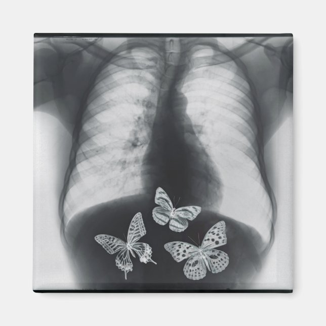 Imán Rayos X de mariposas en el estómago (Frente)