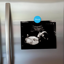 Refrigerador con pantalla de ultrasonido de nombre