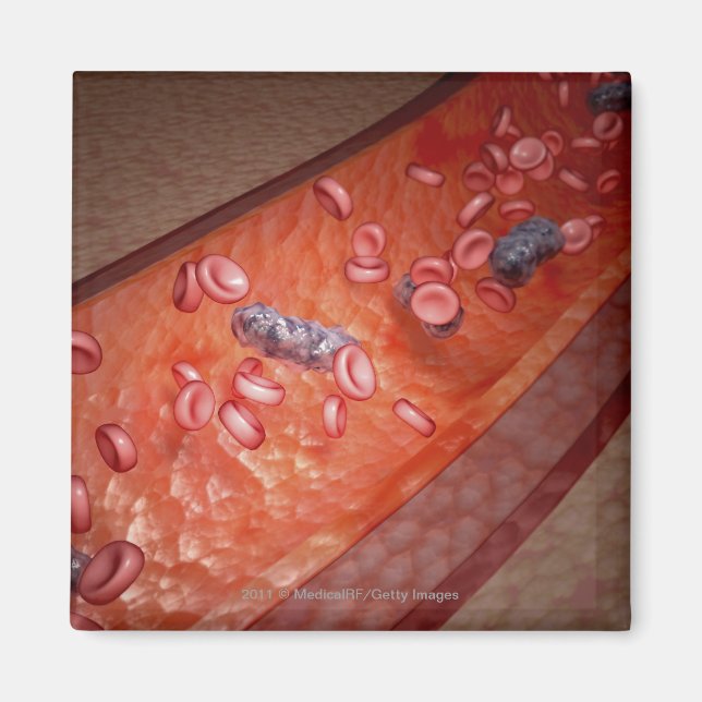 Imán Renderización microscópica de una infección sanguí (Frente)