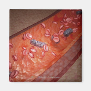 Imán Representación microscópica de una infección de