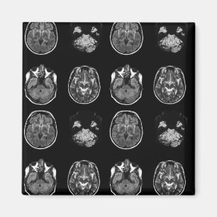 Imán Resonancia magnética cerebral