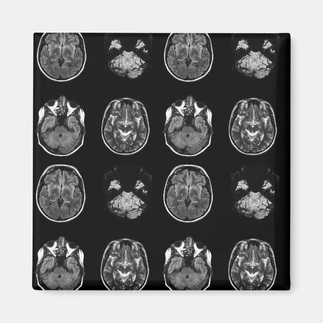 Imán Resonancia magnética cerebral (Frente)