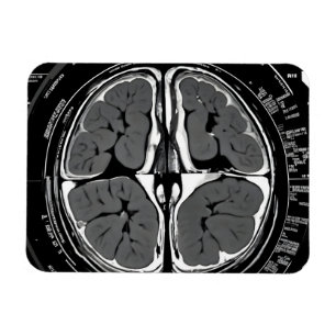 Imán Revisión cerebral por resonancia magnética