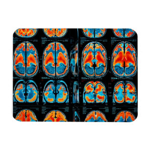 Imán Revisión cerebral por resonancia magnética
