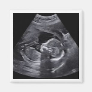Imán Sonograma preñado Foto Entretenimiento Keepsake di