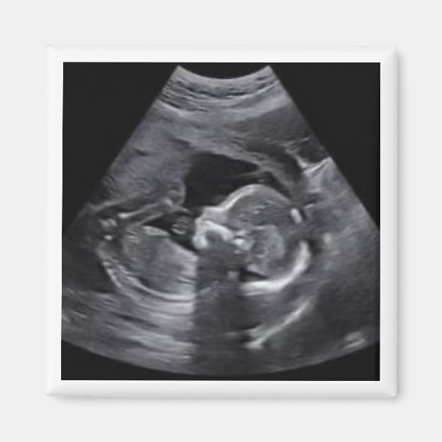 Imán Sonograma preñado Foto Entretenimiento Keepsake di (Frente)
