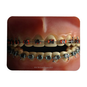 Imán Un modelo dental y apoyos de los dientes